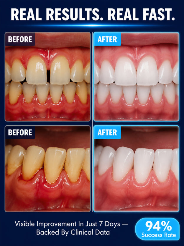 【Restore youthful vitality and smile】Teeth repair whitening gel，7x deeper penetration repairs gums, restoring a youthful, white smile in 7 days!