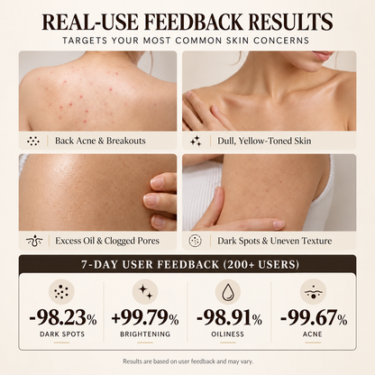 🌿 Niacinamide Skin Soap – Brightens, Fades Spots & Freckles