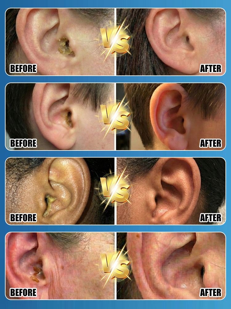 🚀 Pro-Clinic Flush: 1 Spray to Total Clarity, Stop Swab Damage