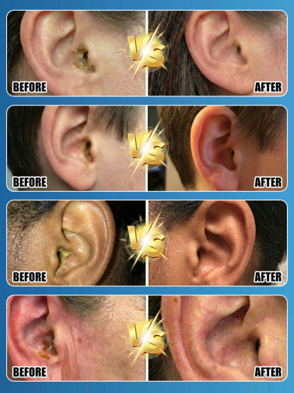 🚀 Pro-Clinic Flush: 1 Spray to Total Clarity, Stop Swab Damage